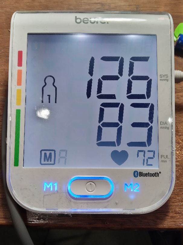 تعمیر فشارسنج بیورر